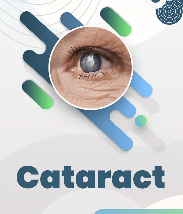 cataract