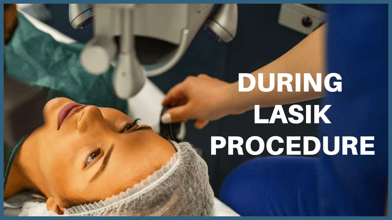 SIRIUS LASIK LASER