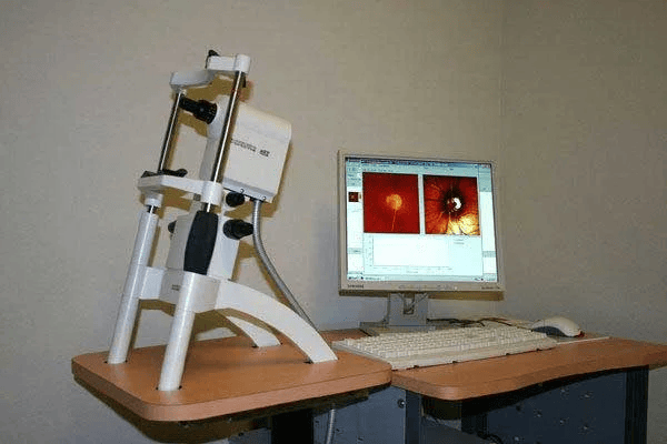Heidelberg Retina Tomograph 2 (HRT‑2)